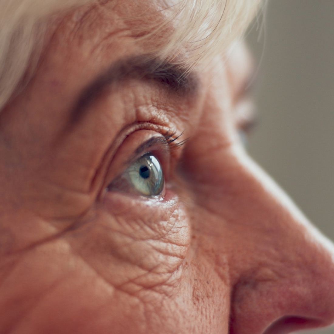 Glaucoma