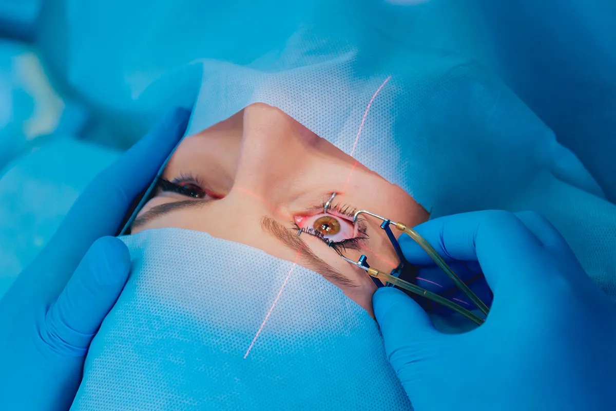 Cirurgia refrativa a laser
