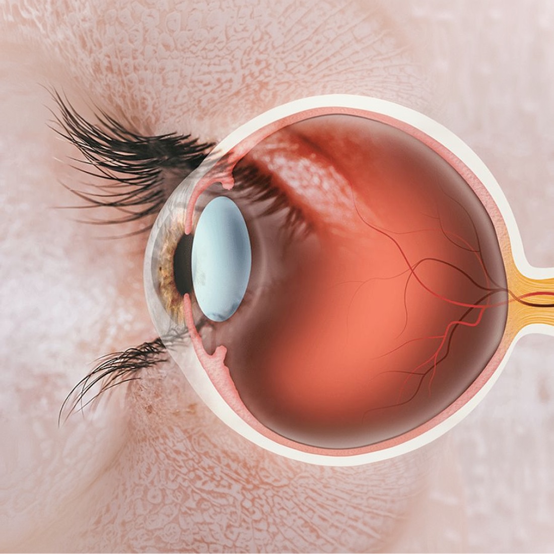 Ilustração do olho mostrando a retina e o nervo óptico